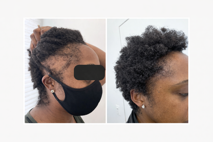 Youth Revival Ritual™ High Frequency Wand