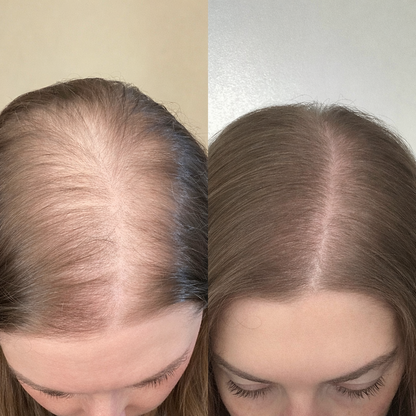 Youth Revival Ritual™ High Frequency Wand